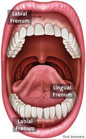 what a frenectomy is and why your child