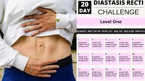 diastasis recti workout challenge