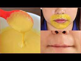 remove upper lips hair naturally