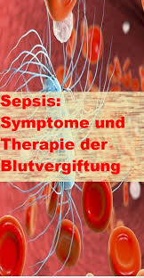 Learn about sepsis (blood infection) symptoms, risk factors, causes, treatment, survival rate, and prevention. Pin Auf Tipps