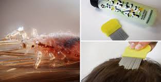 head lice treatments