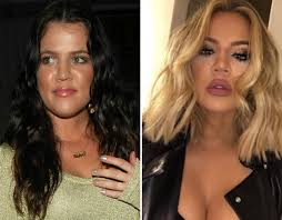 Khloe kardashian surgery obsession may lead to bankruptcy? Khloe Kardashian Before And After See Her Complete Transformation