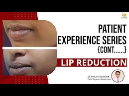 lip reduction surgery cost in bangalore
