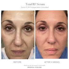 before and afters rodan fields au