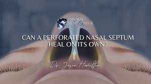 can a perforated nasal septum heal on