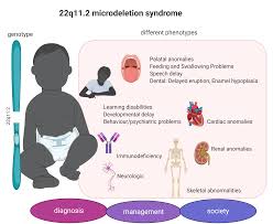 Our study was designed to determine the frequency of 22q11.2 deletion in a retrospectively ascertained sample of patients with conotruncal cardiac defects and structural cardiac defects accompanying other clinical. Genes Free Full Text Consequences Of 22q11 2 Microdeletion On The Genome Individual And Population Levels Html