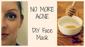 clear acne free skin diy face mask
