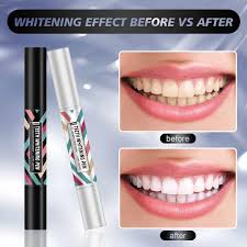 teeth whitening pen gel kit effective