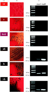 Despite these phenotypic differences, all variants had the same restriction endonuclease profile of plasmid dna. Detection Of Slime Production By Means Of An Optimised Congo Red Agar Plate Test Based On A Colourimetric Scale In Staphylococcus Epidermidis Clinical Isolates Genotyped For Ica Locus Sciencedirect