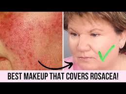 rosacea 5 minute makeup tutorial for
