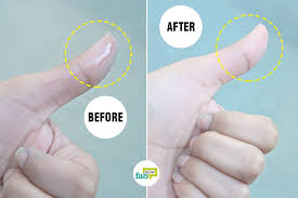 how to remove super glue from skin 4