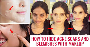 7 life changing tips on makeup for acne