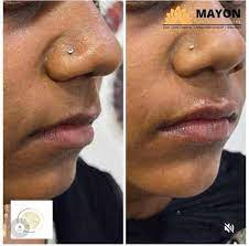 mayon aesthetic centre dental skin