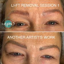 tattoo removal che permanent makeup