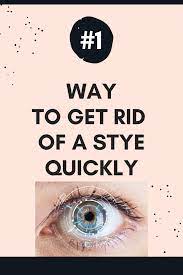 how to get rid of a stye overnight