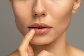reduce bruising after lip fillers