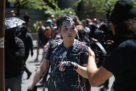 I am a freelance journalist and writer. Andy Ngo Says He Suffered Brain Injury During Portland Mob Beating Oregonlive Com