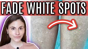 how to fade white spots from sun damage