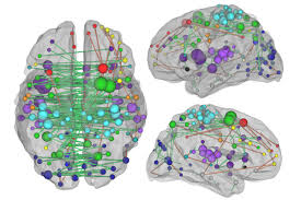 brain networks may aid stroke treatment