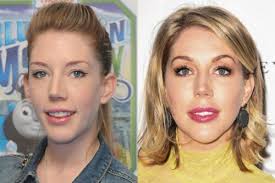 She is known for appearances on many british panel shows including as a team captain on 8 out of 10 cats and guest appearances on never mind the buzzcocks, a league of their own, mock the week, would i lie to you?amongst others. Has Katherine Ryan Had Cosmetic Surgery