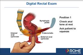 pelvic floor dyssynergia