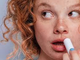 eczema on the lips types symptoms