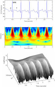 wavelet transform of human sinus rhythm