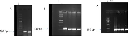 precise isolation of high quality rna