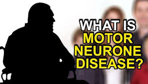 what are the symptoms of motor neurone