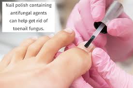 6 home remes for toenail fungus