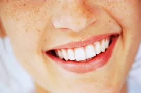 black gums symptoms causes and treatment