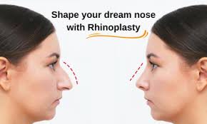 shape your dream nose with rhinoplasty