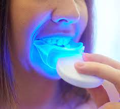 teeth whitening kit from your dentist