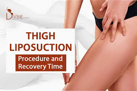 recovery time after liposuction