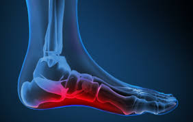 Foot Pain Identifier Foot Com