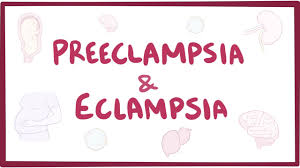 Preeclampsia Eclampsia Causes Symptoms Diagnosis Treatment Pathology