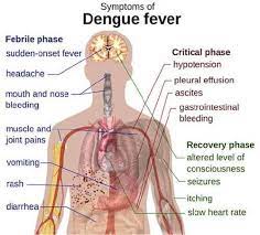 dengue symptoms complications and