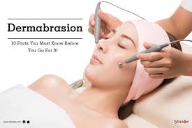 dermabrasion 10 facts you must know