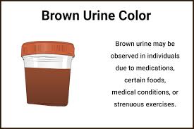 urine color indicate about your health