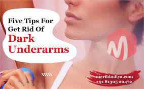 5 tips to getting rid of dark underarms