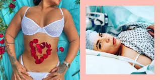 c section scars celebs who have