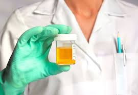 dark urine symptoms causes and treatment