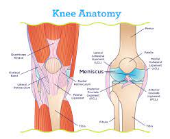 meniscus tears by knee specialist