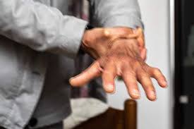 hand tremors explained cala health