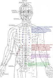 Image Result For Acupuncture Needle Placement Acupuncture