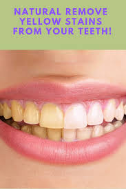 It also takes longer for your dentist to clean all the stains off your teeth at your checkups. Pin On Health Medicine