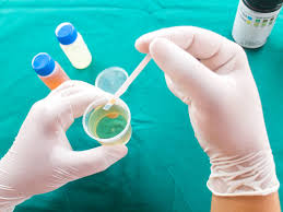Bilirubin Blood Test Procedure Preparation And Risks