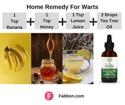 how to remove warts 15 most effective