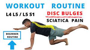 l5 s1 disc bulges and sciatica pain