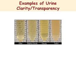 Urine Clarity Chart Bedowntowndaytona Com